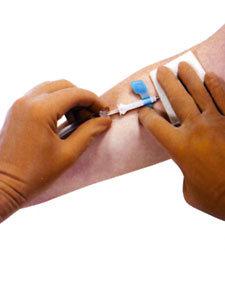 Nipro SafeTouch II Needle Removal